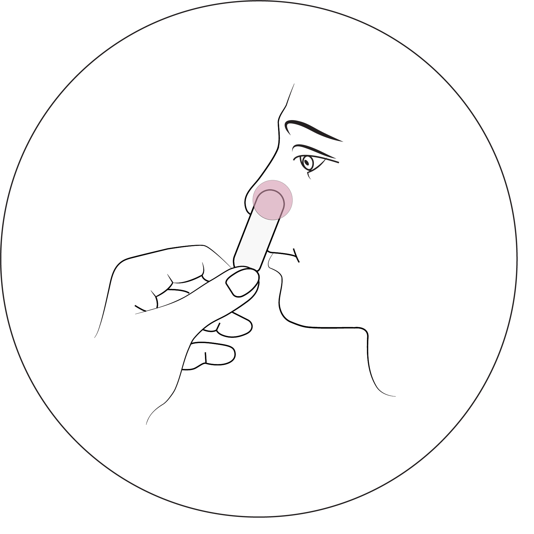 An illustration showing gently insert nozecalm plug into the nostril experiencing bleeding.