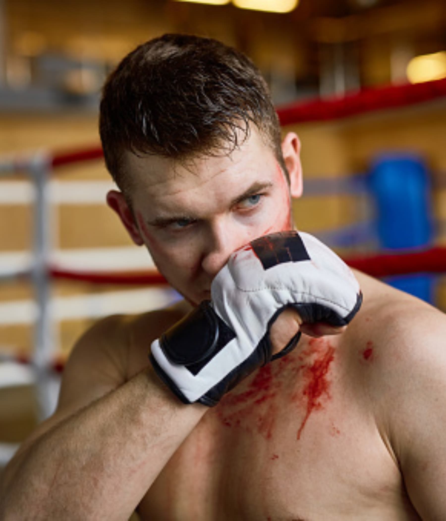 An athlete with a nosebleed during a game, a situation where NozeCalm provides a fast-acting stopper.